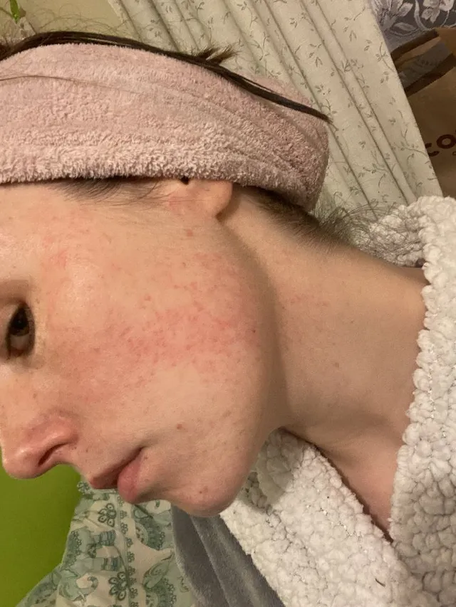 Help what’s happening to my skin!