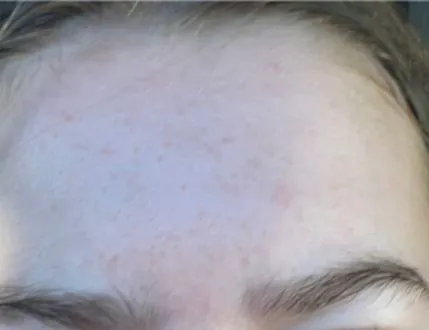 HELP! Does anyone know how to treat this skin on my